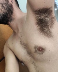 photo-thumb
