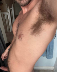 photo-thumb
