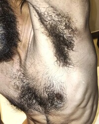 photo-thumb