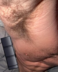 photo-thumb