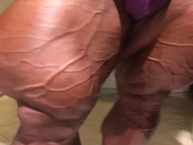 Huge Quads and Huge Bulge - Both are so distracting