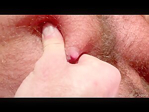 Thumb 8