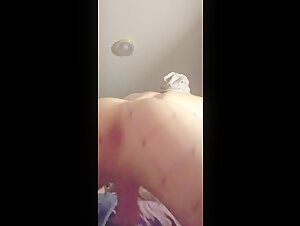 Thumb 9